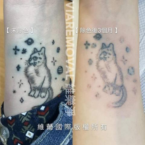 蘇小姐 - 刺青除色服務