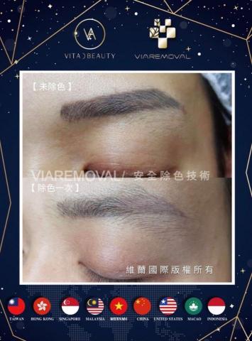 蘇小姐 - 眉毛除色服務