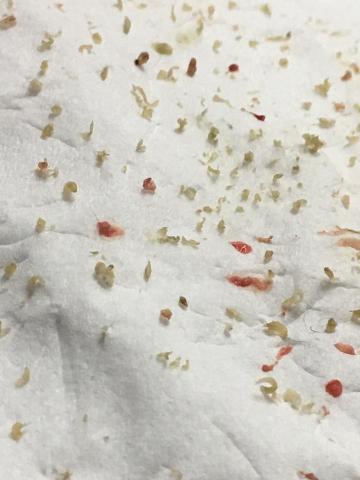 Her spa 肌膚美學 - 純手工清潔毛孔髒污