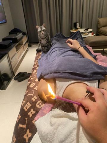 友松到府按摩 - 耳燭排出顱內濕氣