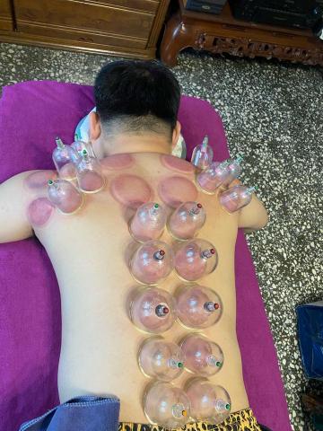 友松到府按摩 - 拔罐排除濕氣