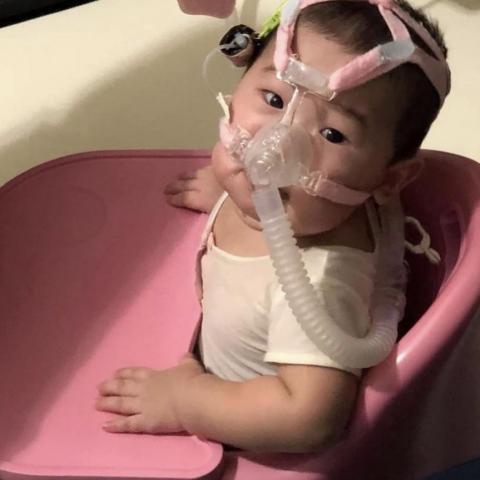 特別護理師 到府育嬰師服務 - 呼吸器寶寶