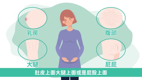 Nora - 衛教知識型影片
影片連結：https://drive.google.com/file/d/1JjM0QQfXmKQkap5HdZQElEOihdxLGpZi/view?usp=sharing