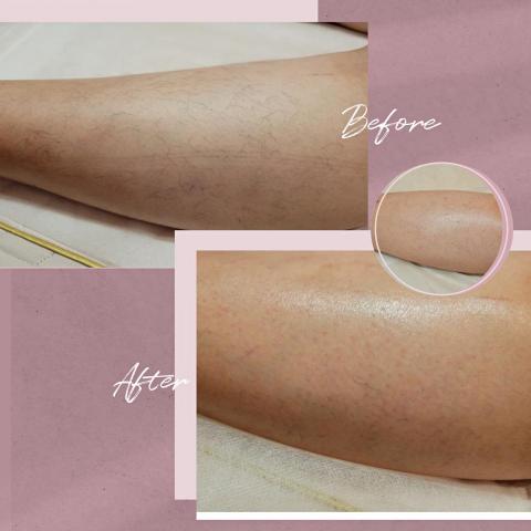 Angel's 整體造型/新娘秘書 - 小腿熱蠟除毛