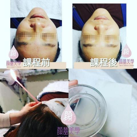 顏囍／囍顏美學 - 臉部保養與耳燭