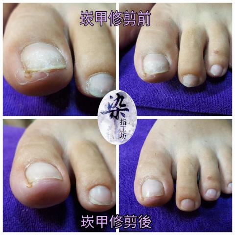 染指工坊國際美甲沙龍台中 - 專業崁甲（凍甲）修剪，矯正