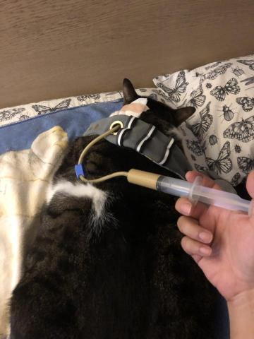 楊臣邑 - 食道胃管餵食