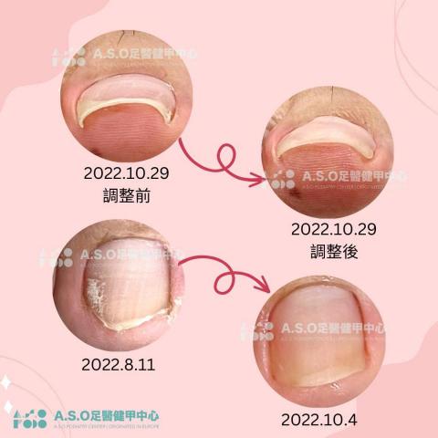 阿瘦足醫健甲中心 - 