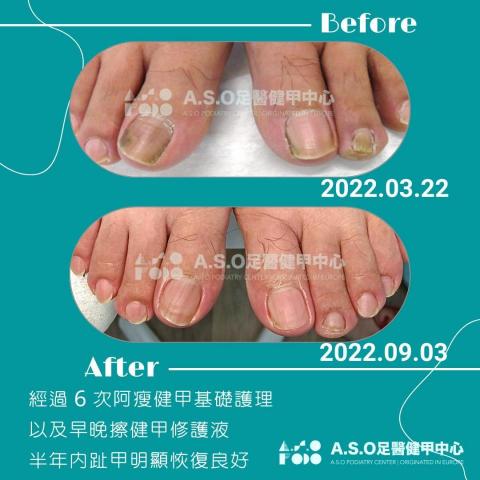 阿瘦足醫健甲中心 - 