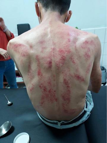 氣電融合摧經絡術 - 