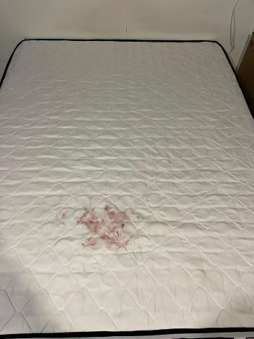 豪乾淨除蟎清潔 - 智齒流血