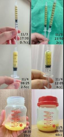 孕婦按摩、泌乳、美胸、熱蠟、產後瘦肚子➡️幸福泌乳 - 