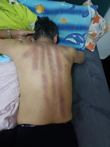 台中經絡腳底按摩（可到府服務） - 刮痧