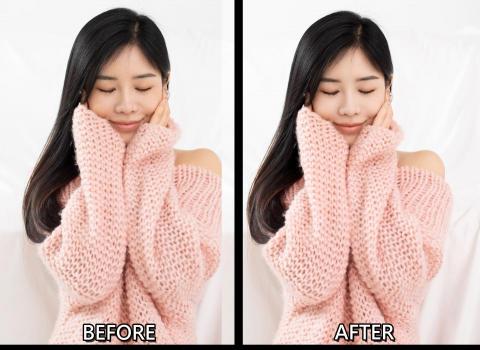 Waterpp - 臉蛋酒窩自然化不再顯得臉大且少女
主打自然不與本人有印象中的過大差異