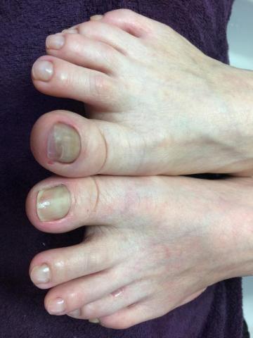 凱瑞莎兒 - 足部崁甲加水晶指甲