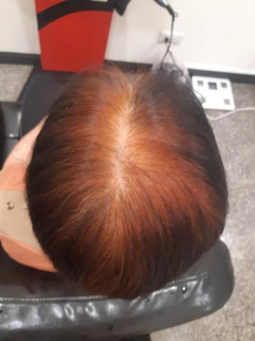 flora spa 健康館 - 第五療程