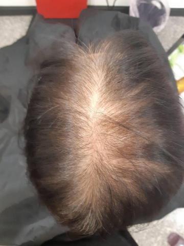 flora spa 健康館 - 未做頭皮療法