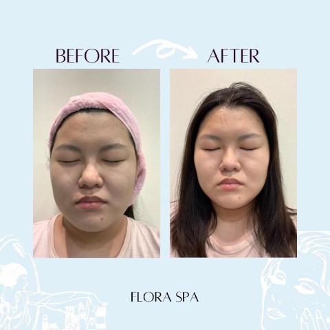 flora spa 健康館 - 杏仁酸課程