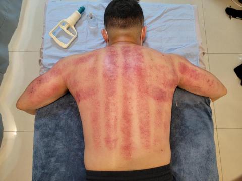 原型運動按摩工作室WORKSHOP2[板橋〕 - 客人滑罐