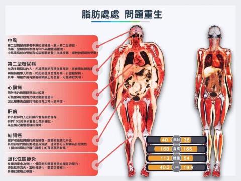 台中教練William|體態改造|客製化計畫|增肌減脂 -  台中教練William|體態改造|客製化計畫|增肌減脂 -