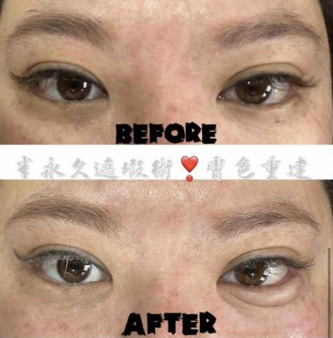 潘欣怡 - 膚色重建 潘欣怡 - 膚色重建