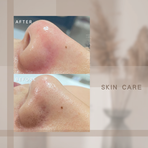 艾爾美自然美學 - 