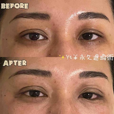 Yi半永久遮瑕·撥筋SPA·熱蠟除毛 - 黑眼圈遮瑕