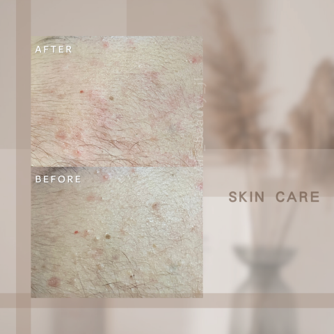 艾爾美自然美學 - 