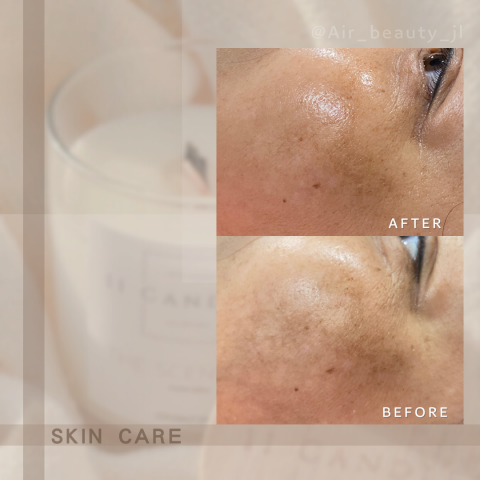 艾爾美自然美學 - 