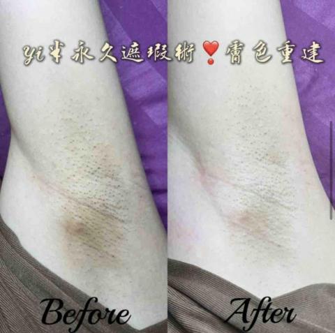 Yi半永久遮瑕·撥筋SPA·熱蠟除毛 - 胳肢窩