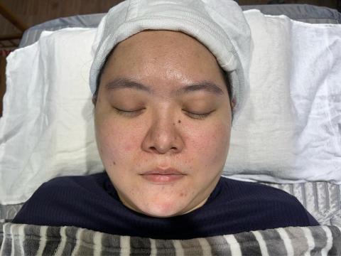 靚芊美學 Beauty More - 女性護膚美容-痘痘肌調理 靚芊美學 Beauty More - 女性護膚美容-痘痘肌調理