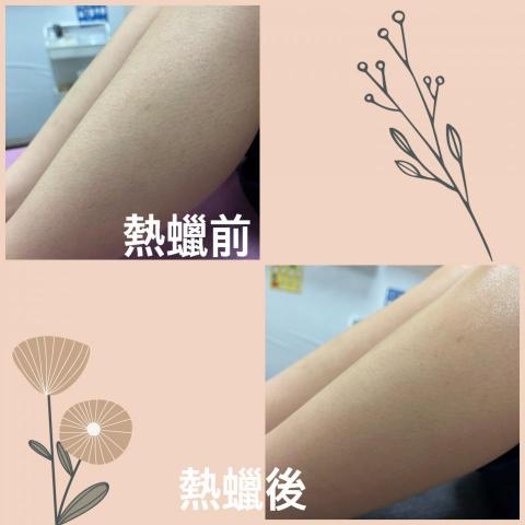wen美學 - 小腿熱蠟美肌