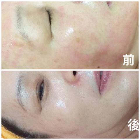 艾菲薇姿健康人文養生館 - 服務完後水嫩光彩！