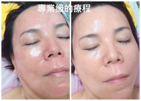 艾菲薇姿健康人文養生館 - 專業級的療程，連過敏性肌膚也晶瑩透亮喔！