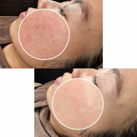 Yunyunchang studio - 今年遇見了最閃亮登場的櫻花套組，闆娘迫不及待推出體驗新優惠活動！
效果實在太顯著惹～～本店只使用正貨喔！
正韓鼎鼎大名的德瑪貝爾 Derbabell新進台灣啊际附
明星課程「櫻花晶亮煥顏」

成份也非常高端：
浆櫻花煥膚凍結乾燥膠原 蛋白-採用超過一般凍結乾燥技術的 (Microporousmatrix手 術用素材)技術，在沒有 Supportmatrix 的前提下以純成分 維持產品質地，並採用通過享越的溶解力和皮膚吸收率 透過皮被吸收的透明質酸 (transdermal hvaluronic acid)