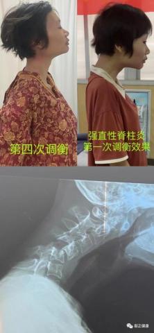 黃勇翰運動科學家/畢業於QS運動科學學科全球第一澳洲雪梨大學 - 蔡秋琴教授調理案例