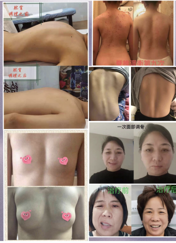 黃勇翰運動科學家/畢業於QS運動科學學科全球第一澳洲雪梨大學 - 蔡秋琴教授調理前後案例