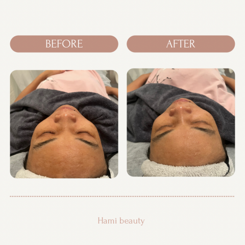 hami beauty - 日常保養