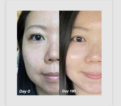 Jasper - 坑洞凹疤
都有效
省下做臉醫美的錢
還能幫妳徘藥性跟重金屬成分
做完醫美更要術後保養?
才能修護好皮膚 Jasper - 坑洞凹疤
都有效
省下做臉醫美的錢
還能幫妳徘藥性跟重金屬成分
做完醫美更要術後保養?
才能修護好皮膚