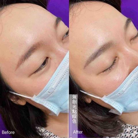 BIRDY台北新北霧眉|無創除色|單根美睫|冰肌除毛|首次新 - 
