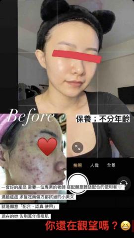 Jasper - 美容師沒有辦法解決的,這裡幫你解決,沒有外力破壞,只有給妳好的保養,就能找回原來的皮膚,好的膚質 Jasper - 美容師沒有辦法解決的,這裡幫你解決,沒有外力破壞,只有給妳好的保養,就能找回原來的皮膚,好的膚質