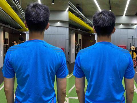 宇旻Rick - 高低肩頰骨矯正 宇旻Rick - 高低肩頰骨矯正