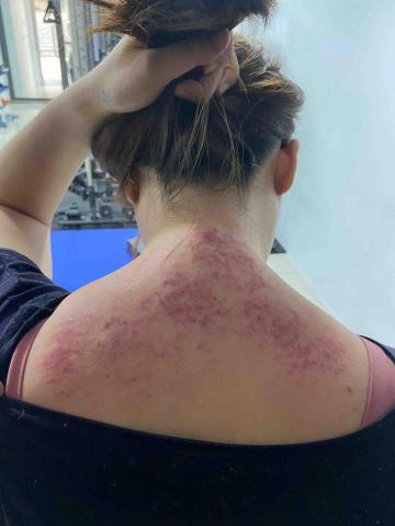 Yuci 健身教練 運動按摩 筋膜放鬆 - 肩頸舒壓放鬆 Yuci 健身教練 運動按摩 筋膜放鬆 - 肩頸舒壓放鬆