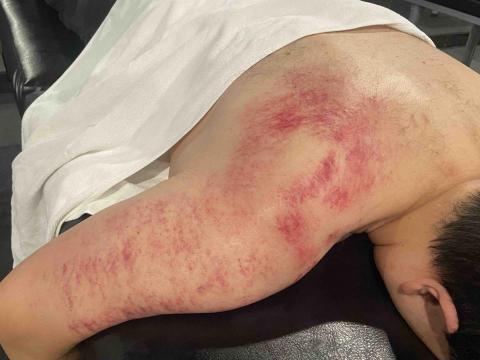 Yuci 健身教練 運動按摩 筋膜放鬆 - 沾黏組織放鬆 Yuci 健身教練 運動按摩 筋膜放鬆 - 沾黏組織放鬆