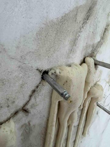 萬德佛 -  止水針施打