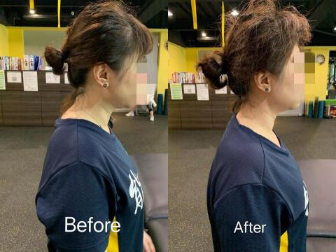 Coach-Roman - 筋膜刀放鬆-肩頸區 Coach-Roman - 筋膜刀放鬆-肩頸區