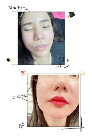 Ling Meng Li - 紋唇