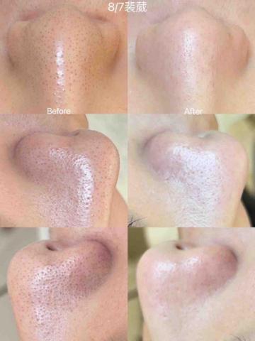 裴小葳 - 對比圖