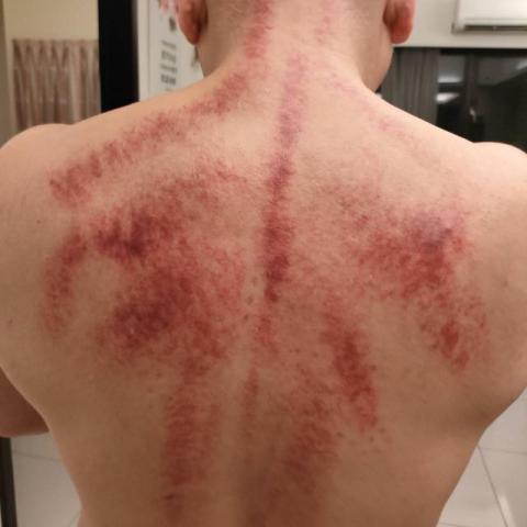 雙北到府--居家.飯店-行動按摩師 - 排毒！排濕氣