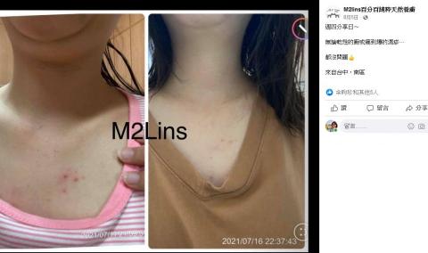 蘇菲 - 關於皮膚變好的見證~